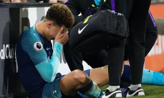 Dele Alli skadet Tottenham Dele Alli skadet Tottenham